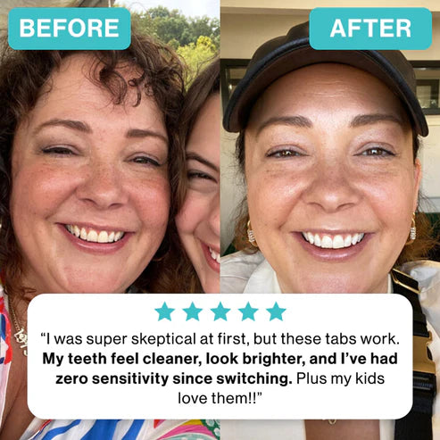 NOBS Toothpaste Tablets (62x per jar)